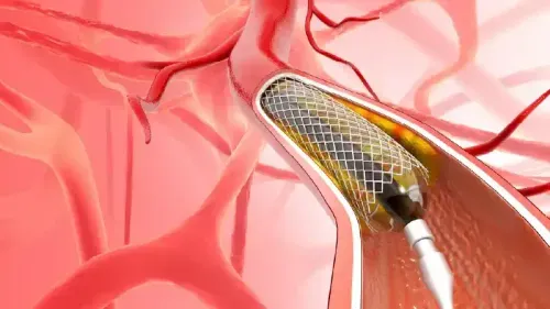 What is the Cost of Cardiac Angiography?